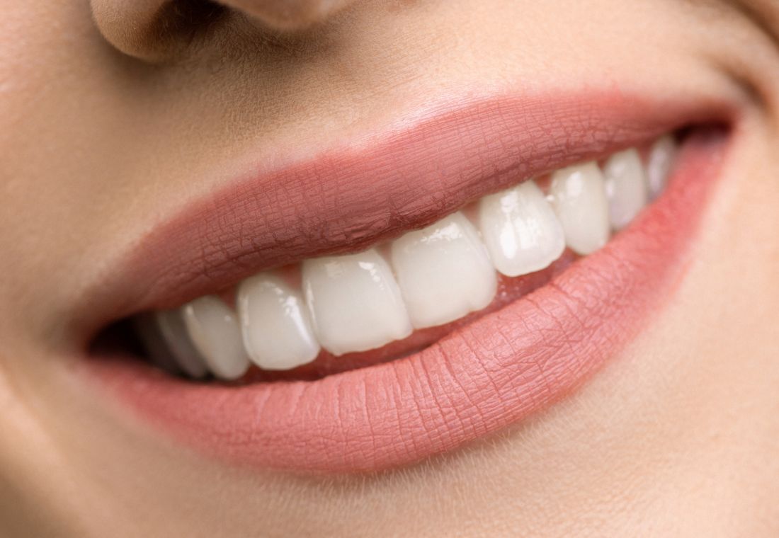 Diseño de sonrisa digital en Dental Line Panamá